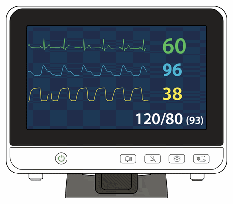 Animated anesthesia monitor waveforms